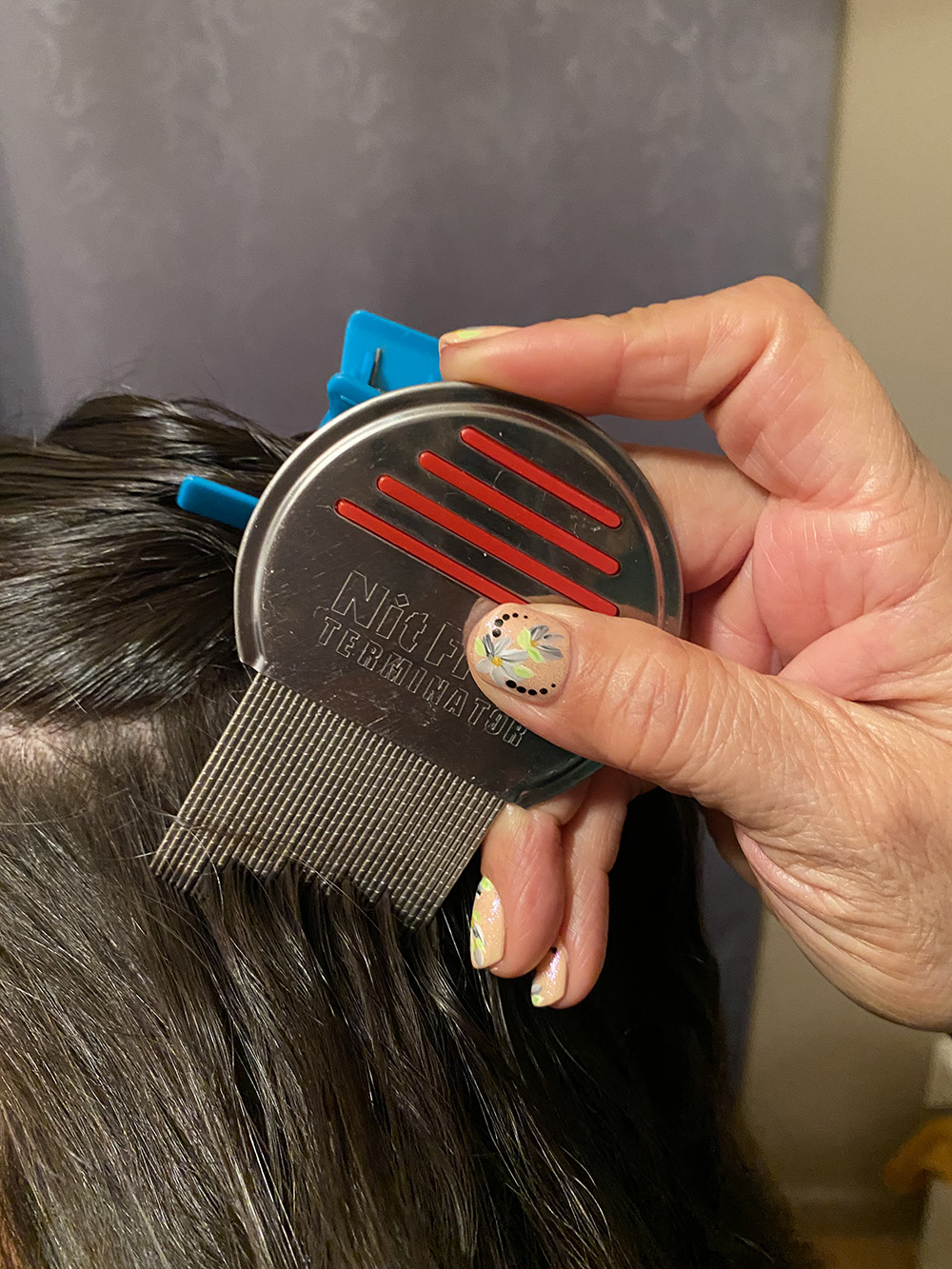 Head Lice Treatment Removal Service in Clovis, California LiceDoctors